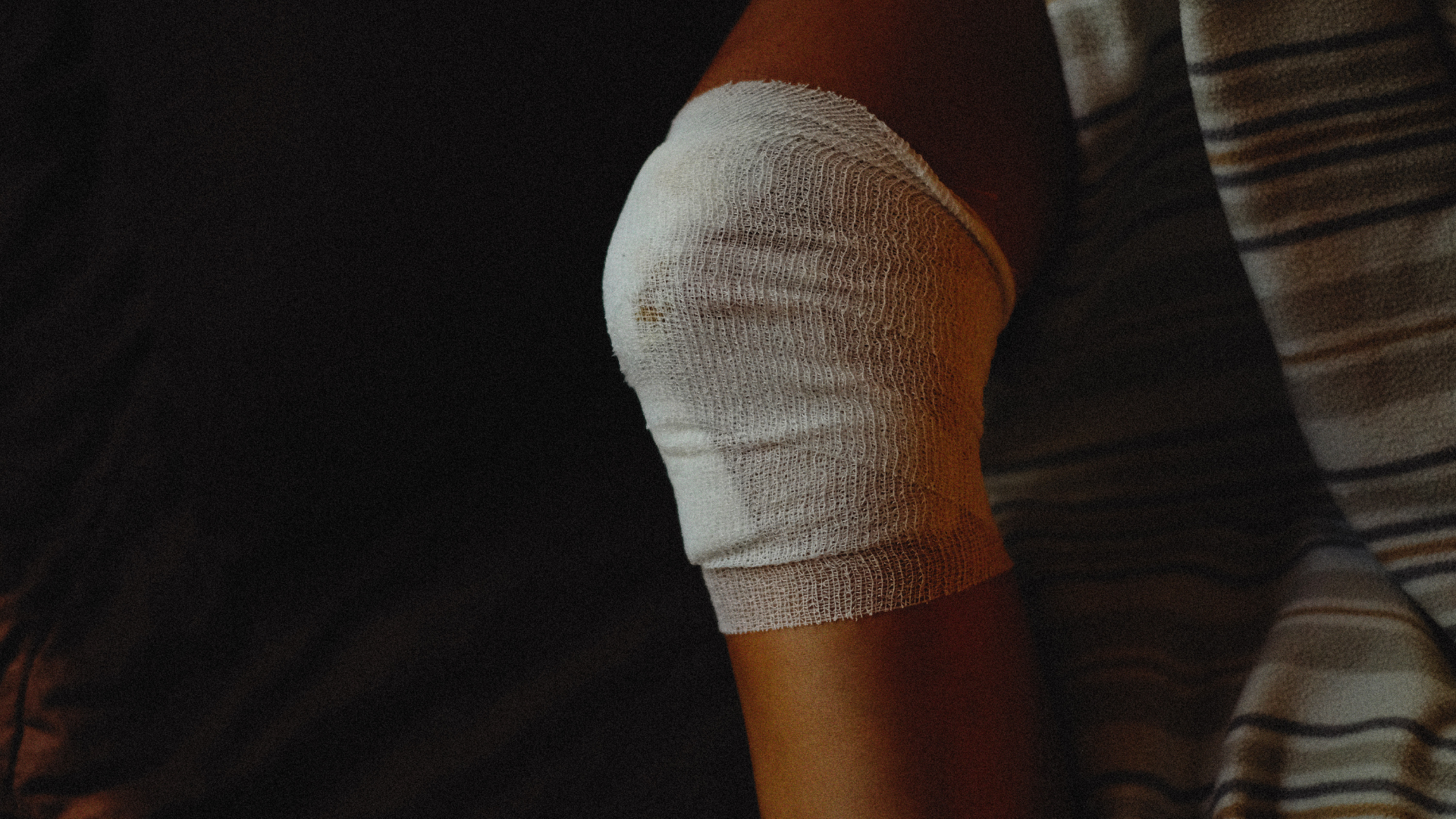 Common Injuries After an Interbay Car Crash